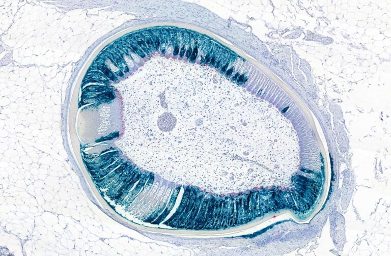 Photo : Service Maladies infectieuses - CHU Toulouse